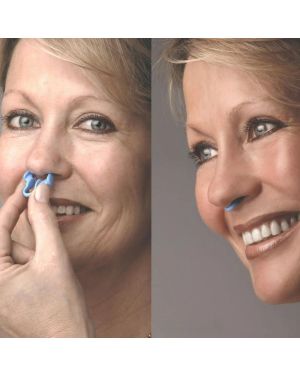 RespiraSoft™ – Dispositif Anti-Ronflement en Silicone (Lot de 2)