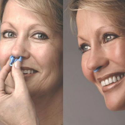 RespiraSoft™ - Silikon-Anti-Schnarch-Gerät (2er-Set)